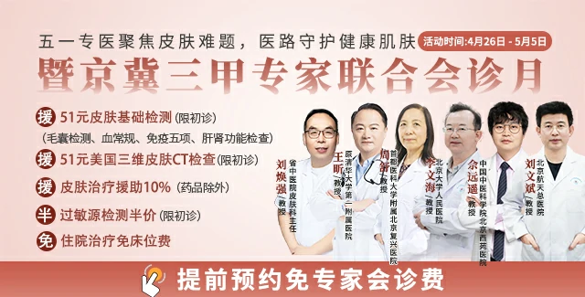 石家庄专业治疗牛皮癣医院